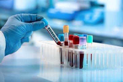 Medical Technician's gloved hand takes test tube out of storage rack